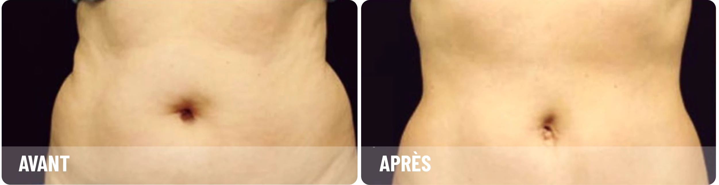 Avant