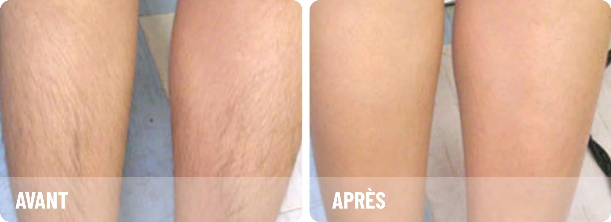 Après