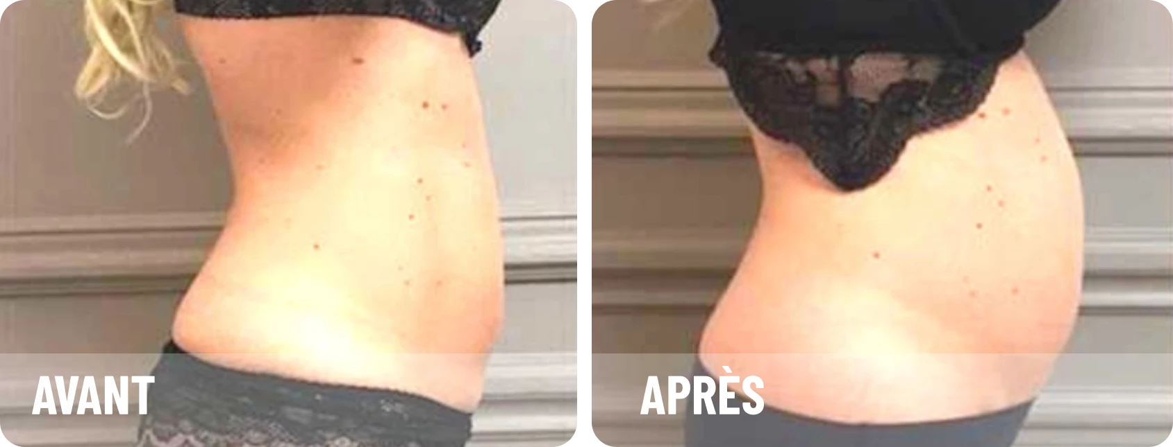 Après
